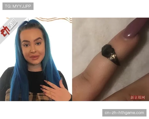 [选手名]心路：在拿到那枚沉甸甸的戒指后，我终于可以对多年前的自己说声：谢谢你没放弃💌